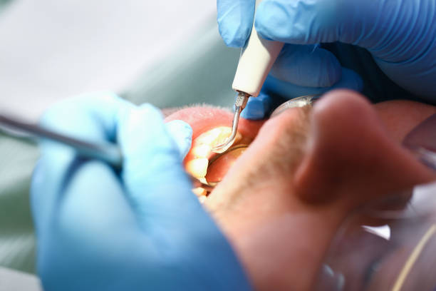 Best Broken Tooth Emergency  in Plano, KY