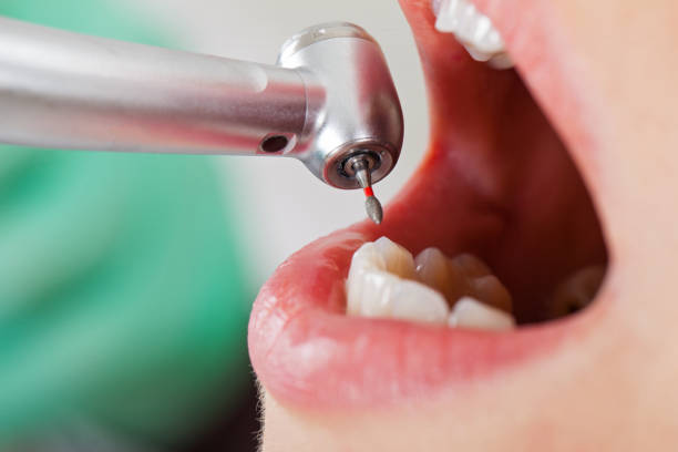 Best Urgent Tooth Repair  in Plano, KY